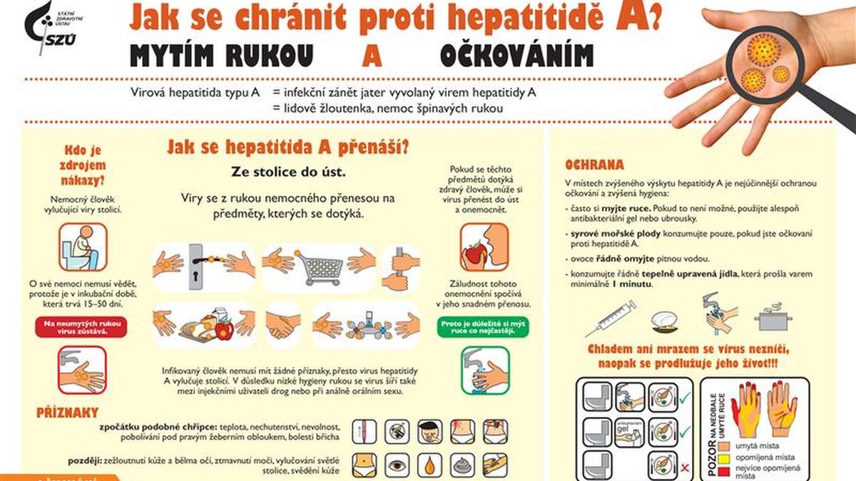 Nákaza žloutenkou dál sílí. Nejvíc případů na obyvatele hlásí Sokolovsko
